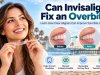 Can Invisalign Fix an Overbite? Learn How Clear Aligners Can Improve Your Bite and Smile