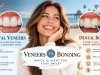 Dental Veneers vs. Bonding: Which Is Right for Your Smile?