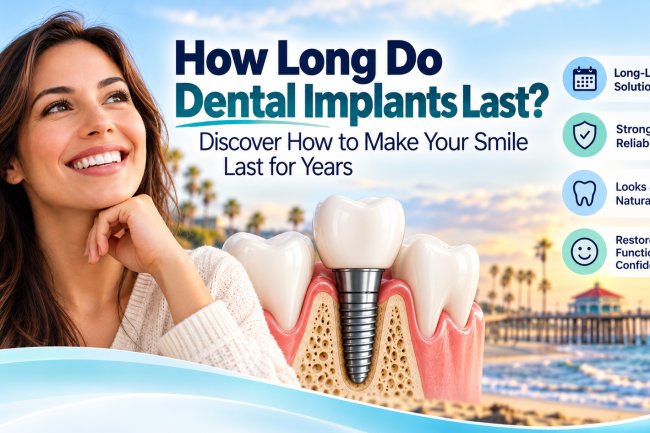 How Long Do Dental Implants Last? Discover How to Make Your Smile Last for Years