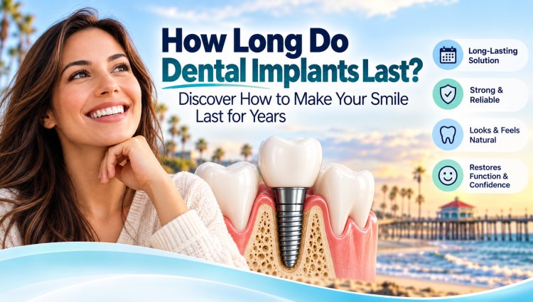 How Long Do Dental Implants Last? Discover How to Make Your Smile Last for Years
