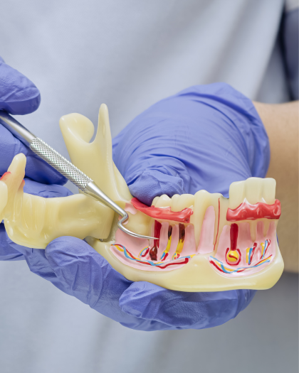 Root canal patient at Aligned Dental House